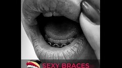 Cute Girls With Braces Showing their smile! Thumb