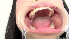 Licking the glass Showing teeth, saliva Thumb