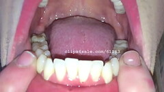 Trice Mouth Video 1 Thumb